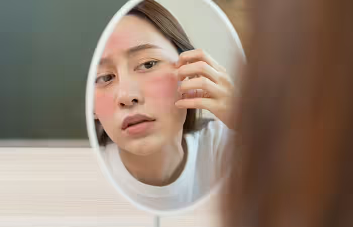 So...What Causes Red Spots on Skin?
