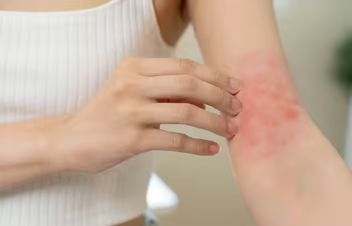 So...What Causes Red Spots on Skin?