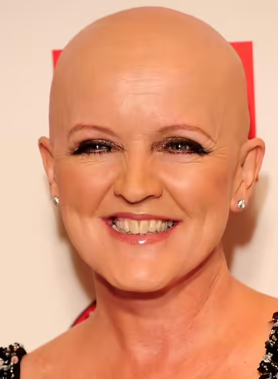 Bold Bald And Beautiful