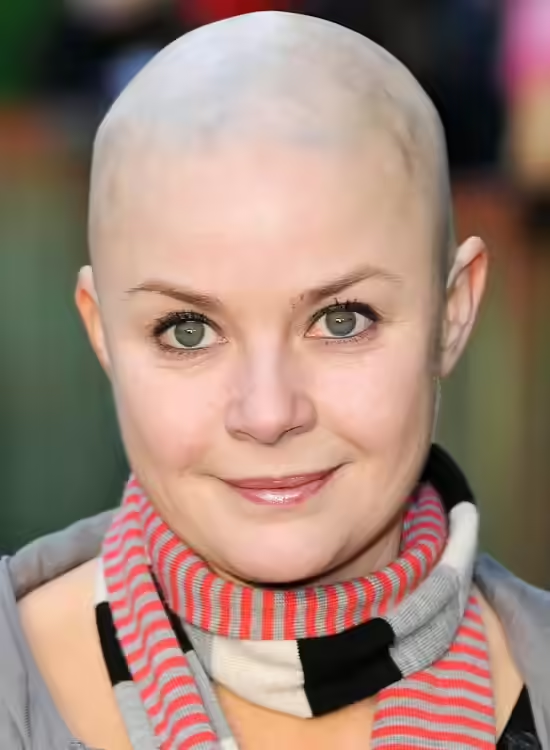 Bold Bald And Beautiful